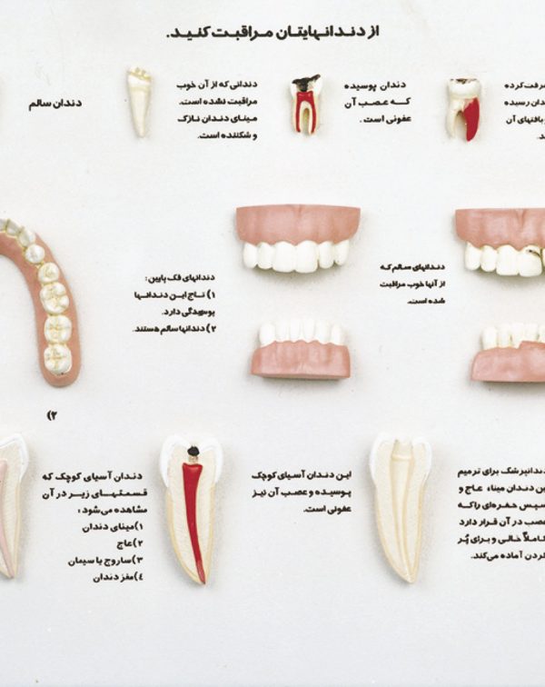 مدل دندان